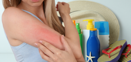 Contact Dermatitis